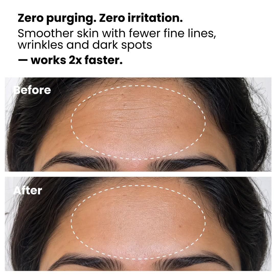 Foxtale 0.15% Retinol Night Serum | Anti-Aging, Reduces Fine Lines & Wrinkles | No Purging | All Skin Types | 30ml